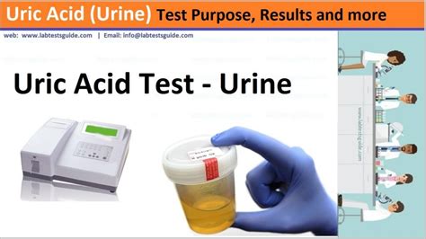 lcf clearing|Uricase method with Lipid Clearing Factor (LCF).